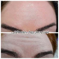 فشیال . مزونیدلینگ‌. خال برداری و آموزش|خدمات آرایشگری و زیبایی|اسلام‌شهر, شهرک سعیدیه|دیوار