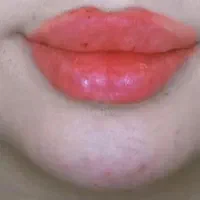 ژل وبوتاکس|خدمات آرایشگری و زیبایی|اهواز, ۲۴ متری|دیوار