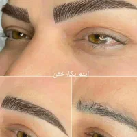 فیبروزم ابرو بهترین کار 1 ملیون