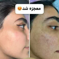 چه روتینی استفاده میکنی