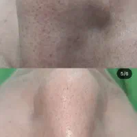 فیشال وپاکسازی،آبرسانی،روشن سازی،جوانسازی،ضدجوش