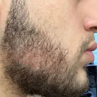 ریش و سبیل رویـشش