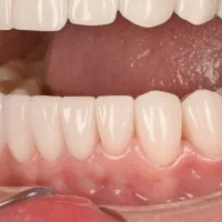 دندانپزشکی تخصصی با ضامنت /اقساطی/وام پزشکی تبریز