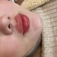 ژل و بوتاکس و خال برداری