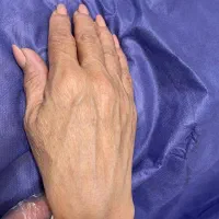 فرمدهی ساعتشنی بدن ساکشن و تزریق چرب|خدمات آرایشگری و زیبایی|رفسنجان, |دیوار