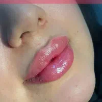 جشنواره تخفیفات پنجاه درصدی کلینیک تخصصی نیکان