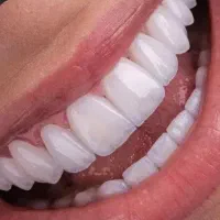 کامپوزیت و لمینت پردیس