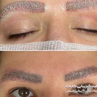 راهنمایی کاشت ابرو
