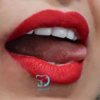 لمینیت لب شیشه قسطی کامپوزیت بلیچینگ دندان|خدمات آرایشگری و زیبایی|مشهد, سجاد شهر|دیوار