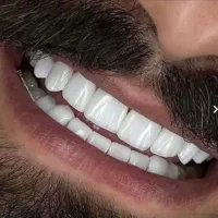 دندانپزشکی،کامپوزیت دندان،روکش دندان|خدمات آرایشگری و زیبایی|شیراز, شهرک ولیعصر|دیوار