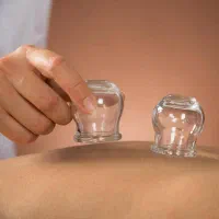 انواع حجامت با قیمت مناسب و کیفیت بالا|خدمات آرایشگری و زیبایی|مشهد, امام خمینی|دیوار