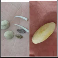 مهره اصلی