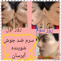 فراخوان پوست سالم بدون جوش