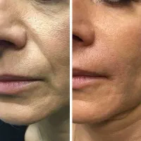 ضدلک و روشن کننده بیومیمتیک