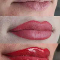 اموزش فیبروز، شیدینگ، میکروپیکمنتیشن 7ملیون