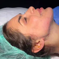 لیپوساکشن کلینیک مهرزاد وی لاین