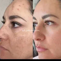 کرم معجزه اصل آلمانی ، ایتالیایی با بهترین مواد|آرایشی، بهداشتی، درمانی|لردگان, |دیوار