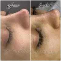 جشنواره پاکسازی و فشیال تخصصی (تخفیف محدود)