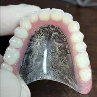 دندانسازی قربان زاده|خدمات آرایشگری و زیبایی|تربتحیدریه, شهدا|دیوار