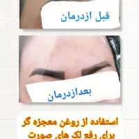 روغن های معجزه گر کاژان