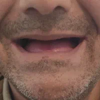 دندان مصنوعی  ( تمام چک )|آرایشی، بهداشتی، درمانی|پارس‌آباد, |دیوار