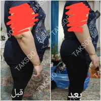 آگهی لاغری