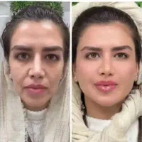 جشنواره تاشنبه)هایفو گلدفقط1/950با20خدمات رایگان