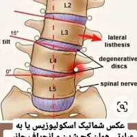 ماساژ