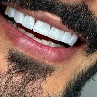تخفیف عید قربان کامپوزیت ونیر ۱.۹۰۰