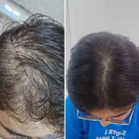 خداحافظی کن با کچلی