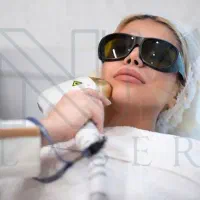 لیزر موهای زائد بانوان