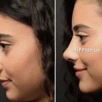 دماغت رو به بینی تبدیل کن