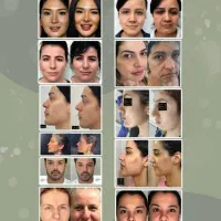 مژذه مژده با ۸تومن کل چهرتو تغییر بده