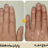 استقلال مالی ودرمان باطب سنتی آنلاین ویژه بانوان|استخدام بازاریابی و فروش|کرج, اکبرآباد|دیوار