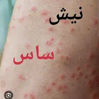 سمپاشی ساس سم پاشی سوسک در تمام نقاط تهران و حومه|خدمات نظافت|تهران, نارمک|دیوار