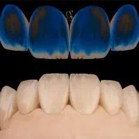 آموزش لابراتوار دندانسازی