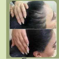 خدمات زیبایی بوتاکس ژل مزو لیزر تخفیف ویژه|خدمات آرایشگری و زیبایی|شیراز, فضل‌آباد|دیوار