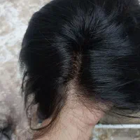 کلاه‌گیس