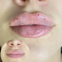 کاشت ابرو/فیشال/تزریق فیلر/لیپوابدو/پی ار پی|خدمات آرایشگری و زیبایی|پیشوا, |دیوار