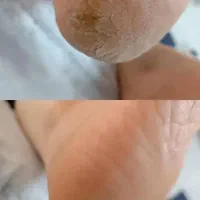 خدمات ناخن و‌پدیکور پا و ژلیش پا به صورت حرفه ای|خدمات آرایشگری و زیبایی|دزفول, |دیوار