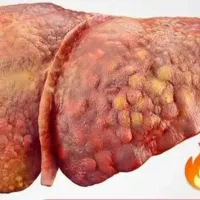 درمان در طبیعت|عمدهفروشی|ساوه, |دیوار