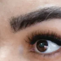 کاشت مژه نچرال و طبیعی