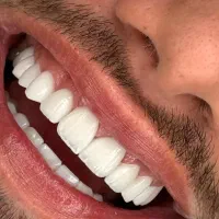 جشنواره دندان پزشکی/ اقساطی/۶