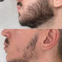 کاشت ممنوع