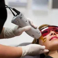 لیزر موهای زائد با جدیدترین دستگاه کندلا