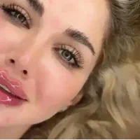 جالپروسوپر هیدرومدل رایگان فیلربوتاکس گازی