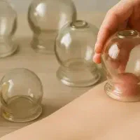بادکش و حجامت