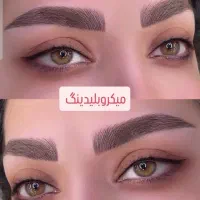 ابرو/لیزر پوست /شیدینگ/لیزر مو سفید/درمان کبد چرب