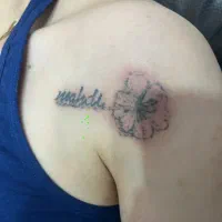 رفع اسکار اکنه  و رفع تتو با دستگاه co2وکیوسوئیچ