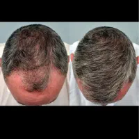 صابون کاملا گیاهی جهت رشد و پرپشتی مجدد مو های شما